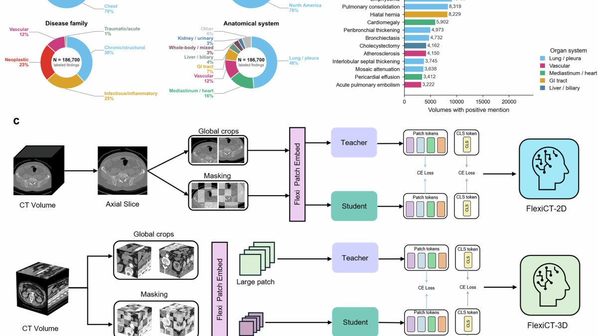 npj Digital Medicine：FlexiCT用26.6万例CT分三阶段预训练，统一五类下游任务