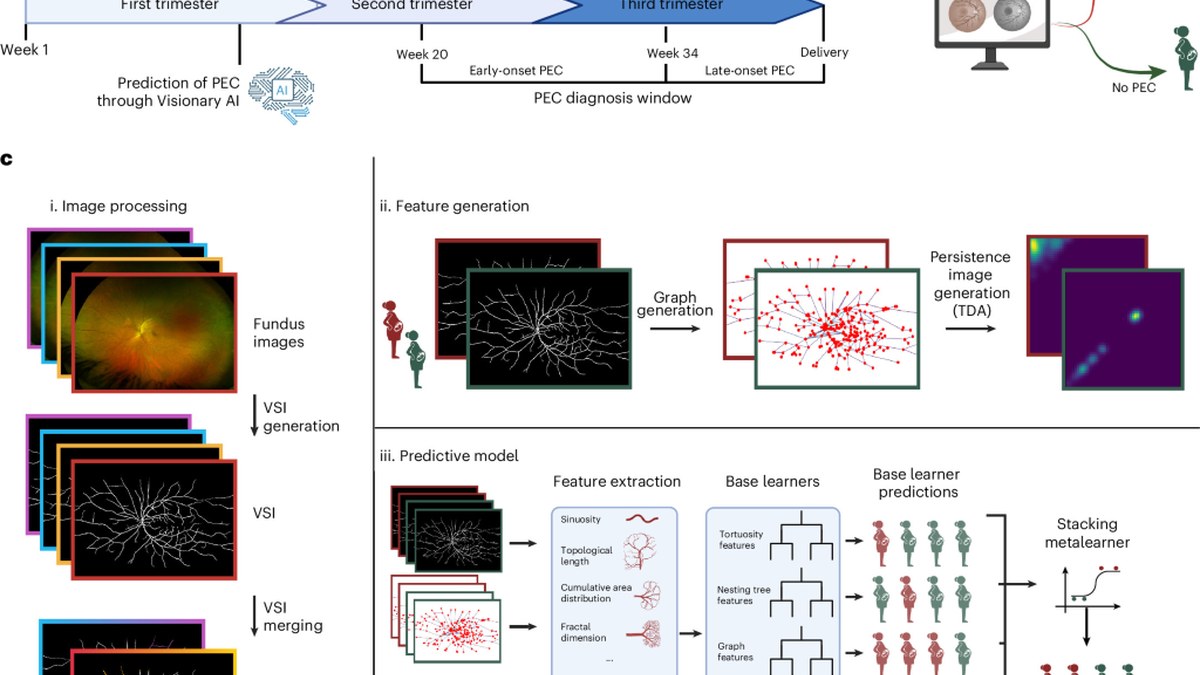 Nature Biotechnology：Visionary AI用眼底图像预测子痫前期，开发队列AUC 0.91，外部验证降至0.81