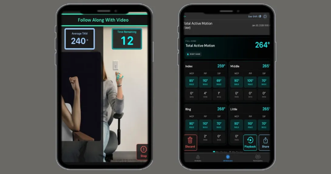 Exer AI 扩大与 Mayo Clinic 合作，把计算机视觉运动评估推向临床部署