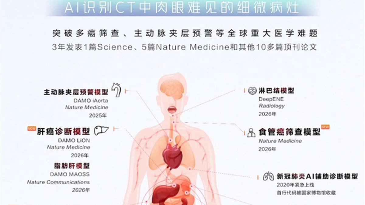 《Nature Medicine》发表达摩院DAMO EAGLE：不插管不造影，平扫CT筛出早期食管癌
