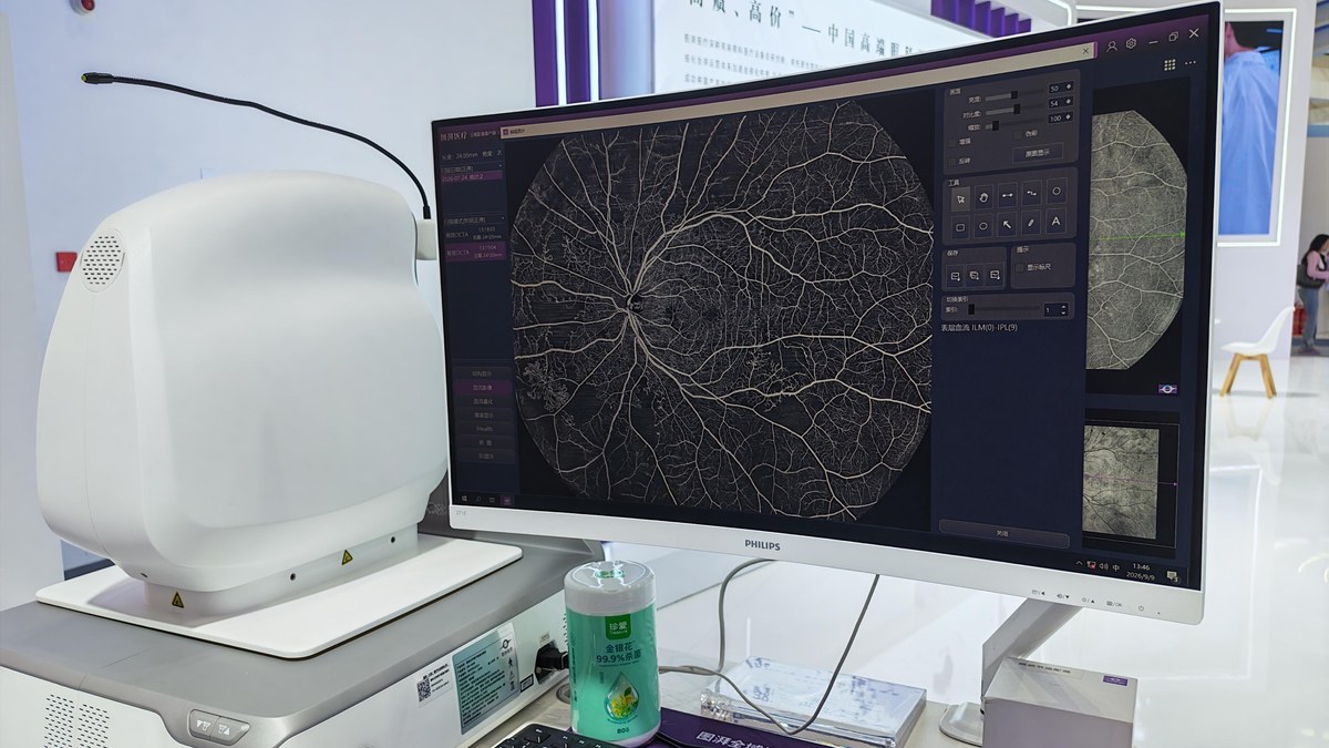一次常规抽血查出早期白血病：检验大模型想当检验科的"第二双眼睛"