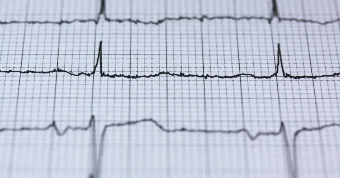 AHA AI Assessment Lab 评估 Ultromics 心衰诊断 AI：可提前数月识别 HFpEF 风险