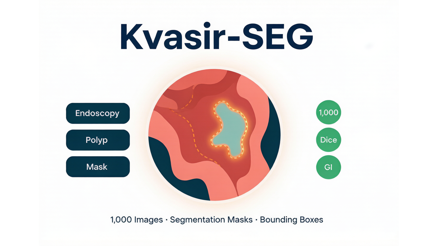 Kvasir-SEG — 胃肠道息肉分割数据集 AI-Ready Wikipedia | 千方病案医数集