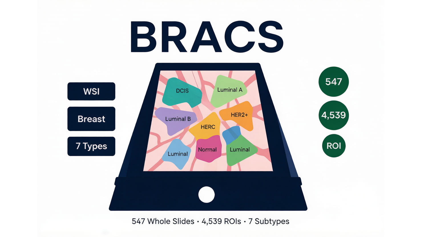 BRACS — 乳腺癌亚型全切片数据集 AI-Ready Wikipedia | 千方病案医数集