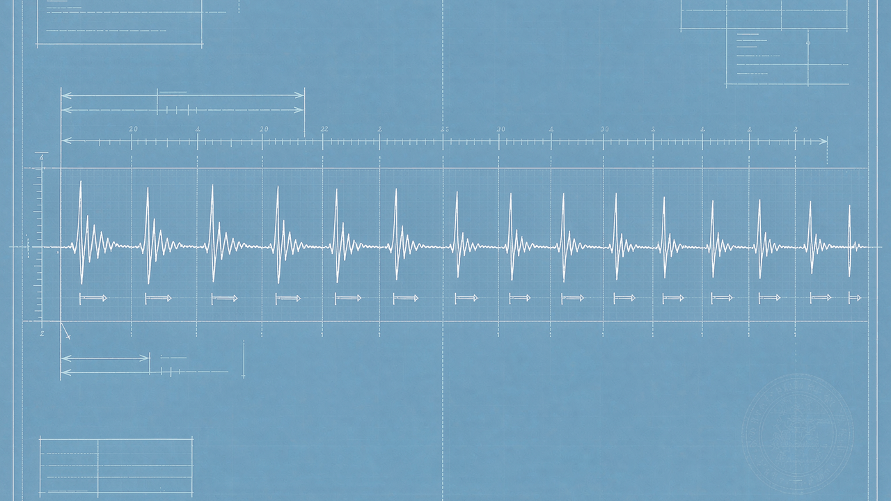 ECG-Arrhythmia:4.5 万份 12 导联心电公开库
