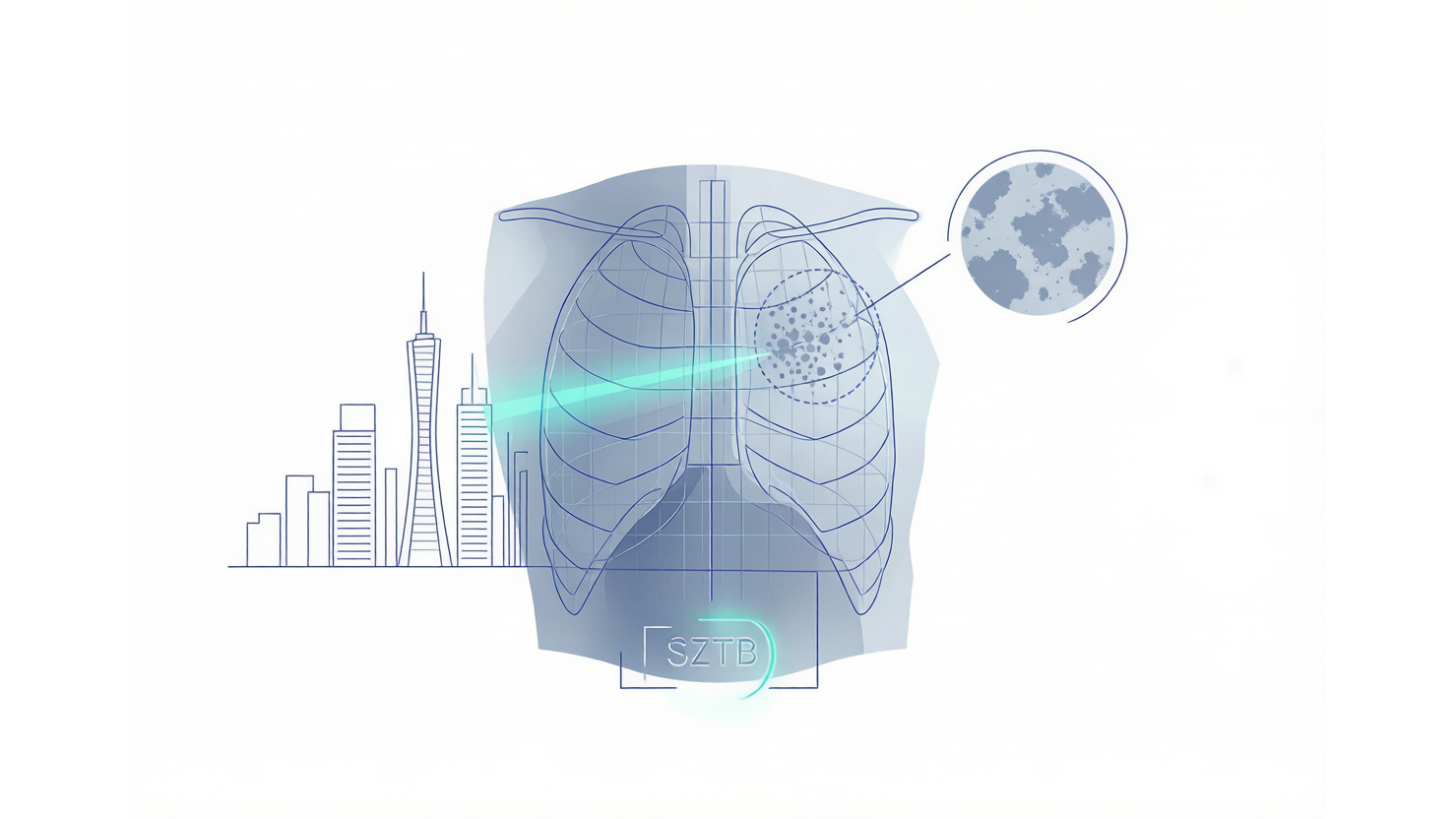Shenzhen TB CXR Set — 深圳结核病胸片基准 AI-Ready Wikipedia | 千方病案医数集