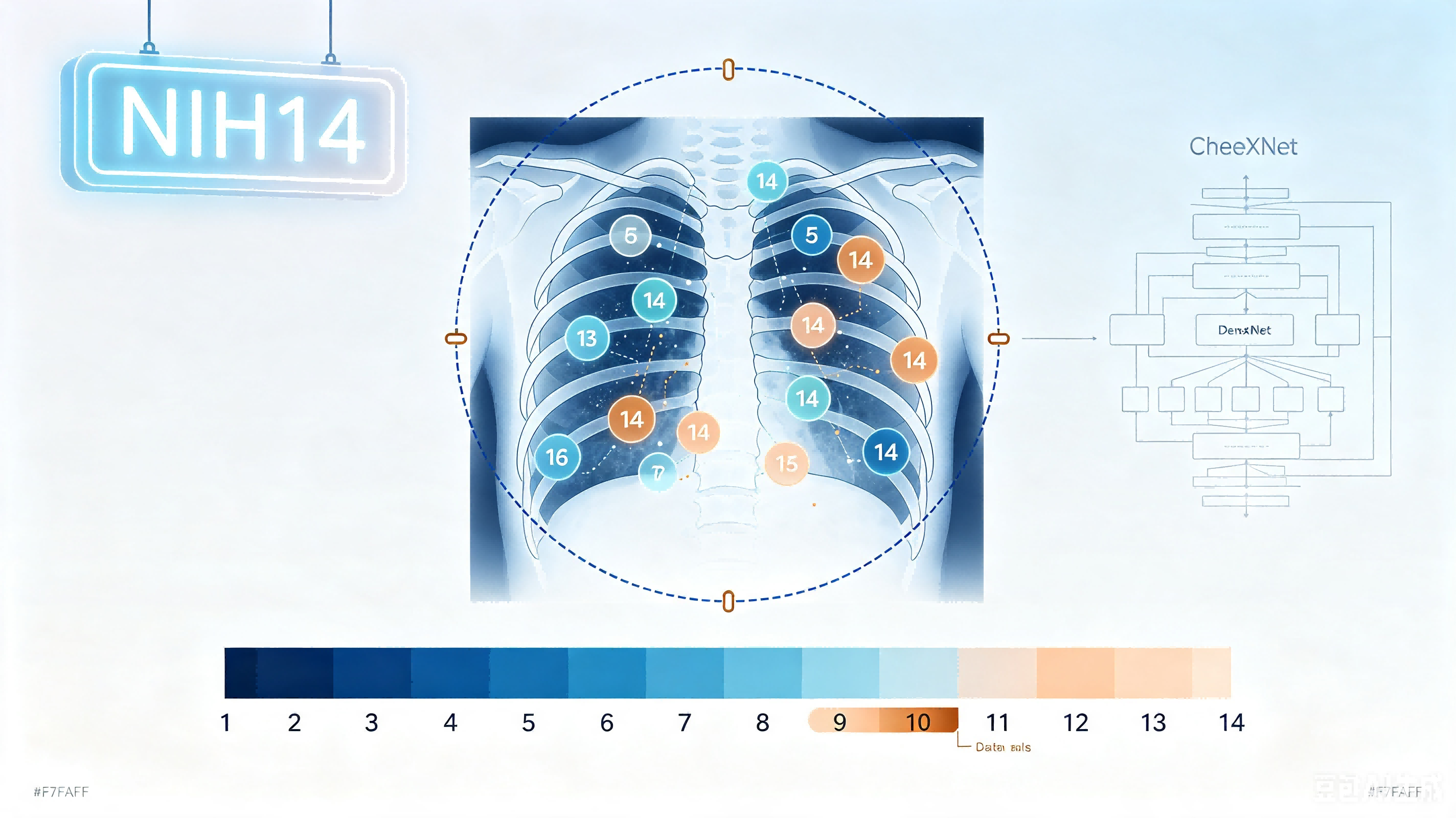 NIH ChestX-ray14 — 大规模胸部 X 光数据集 AI-Ready Wikipedia | 千方医数集