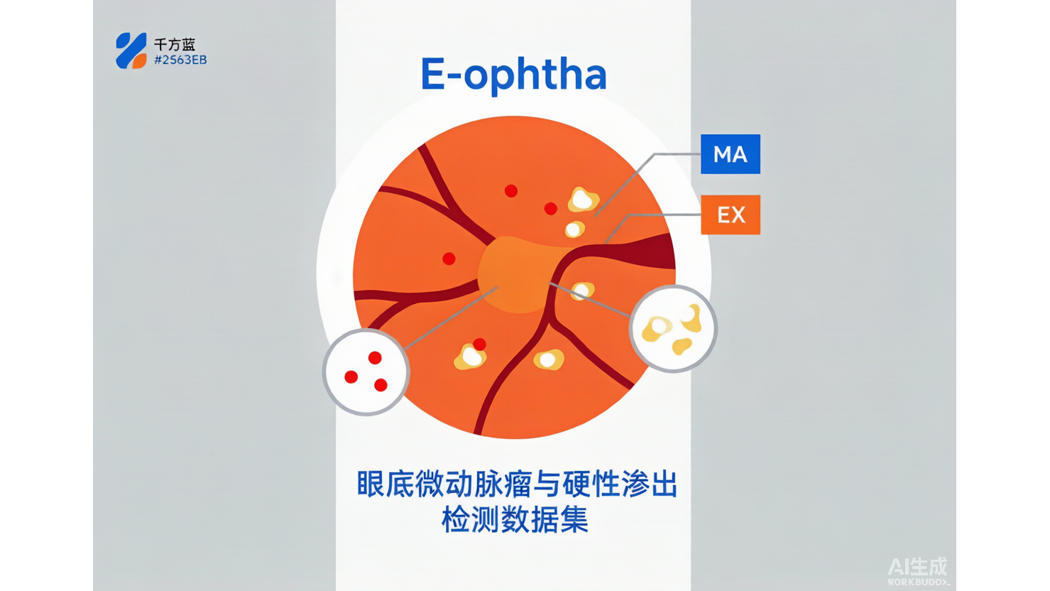 E-ophtha — 眼底微动脉瘤与硬性渗出病灶级标注 AI-Ready Wikipedia | 千方病案医数集