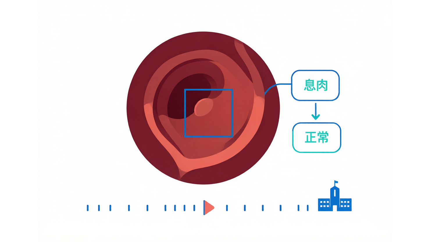SUN Database — 昭和大学结肠镜视频数据库 AI-Ready Wikipedia | 千方病案医数集