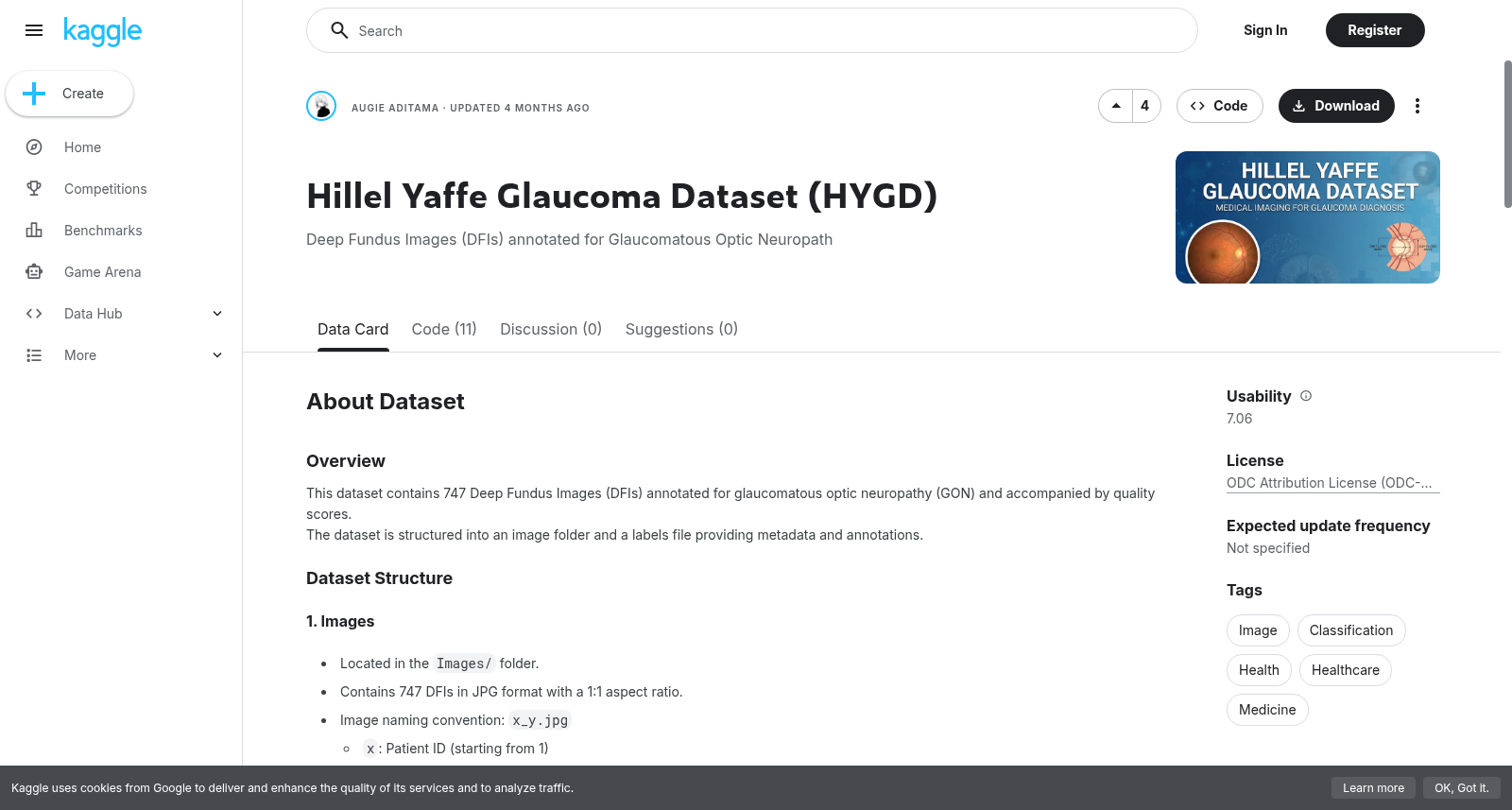 Hillel Yaffe 青光眼数据集 (HYGD)