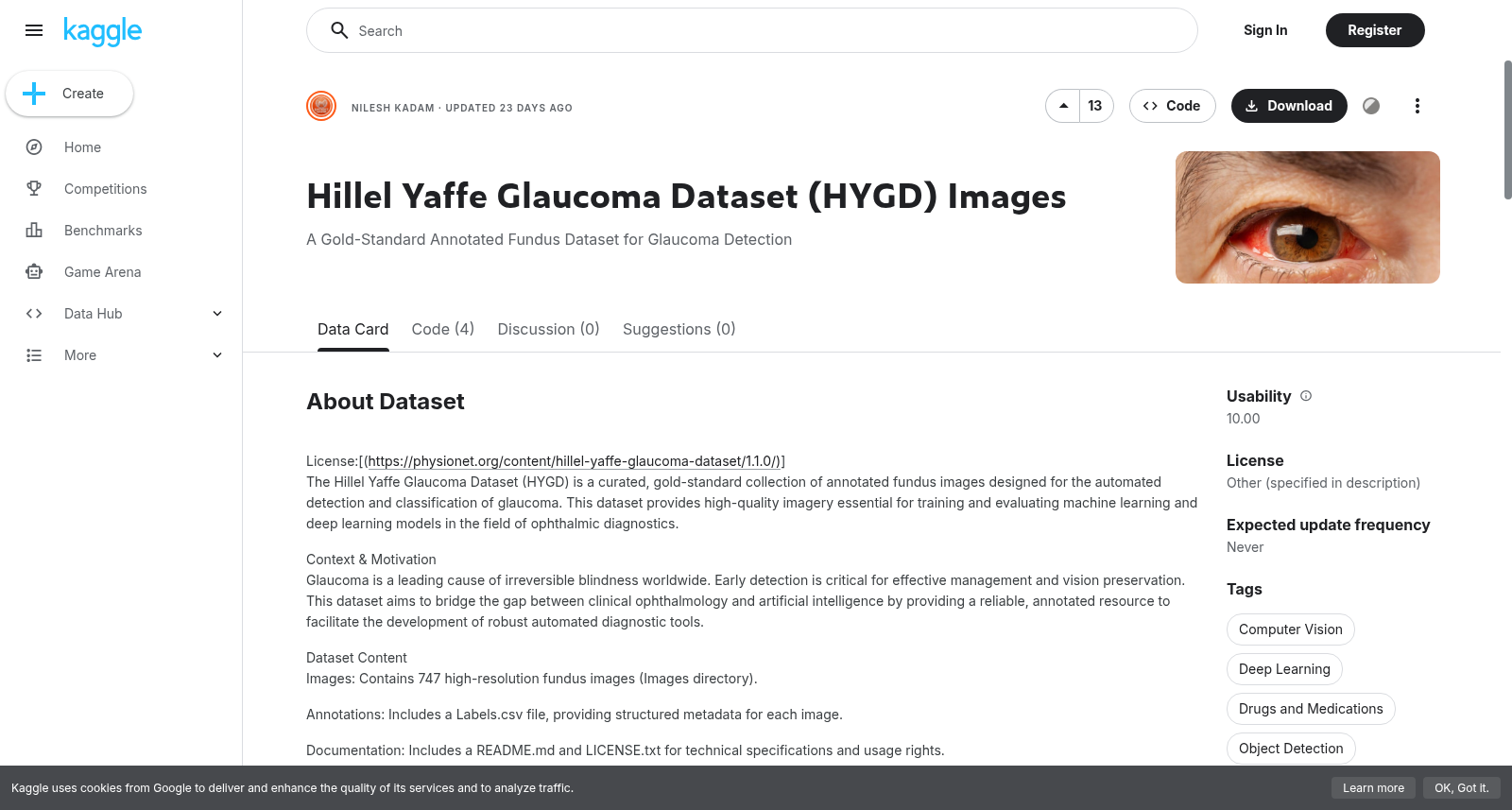 Hillel Yaffe 青光眼数据集 (HYGD) 图像