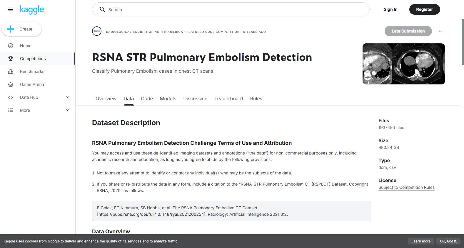RSNA-STR Pulmonary Embolism Detection