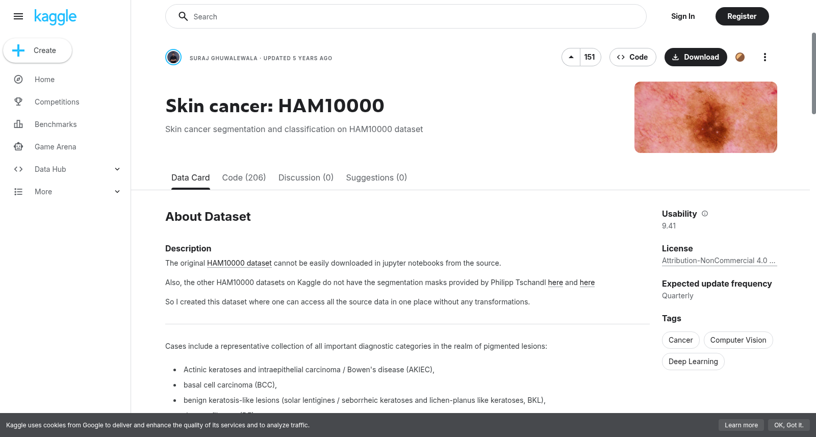 皮肤癌:HAM10000
