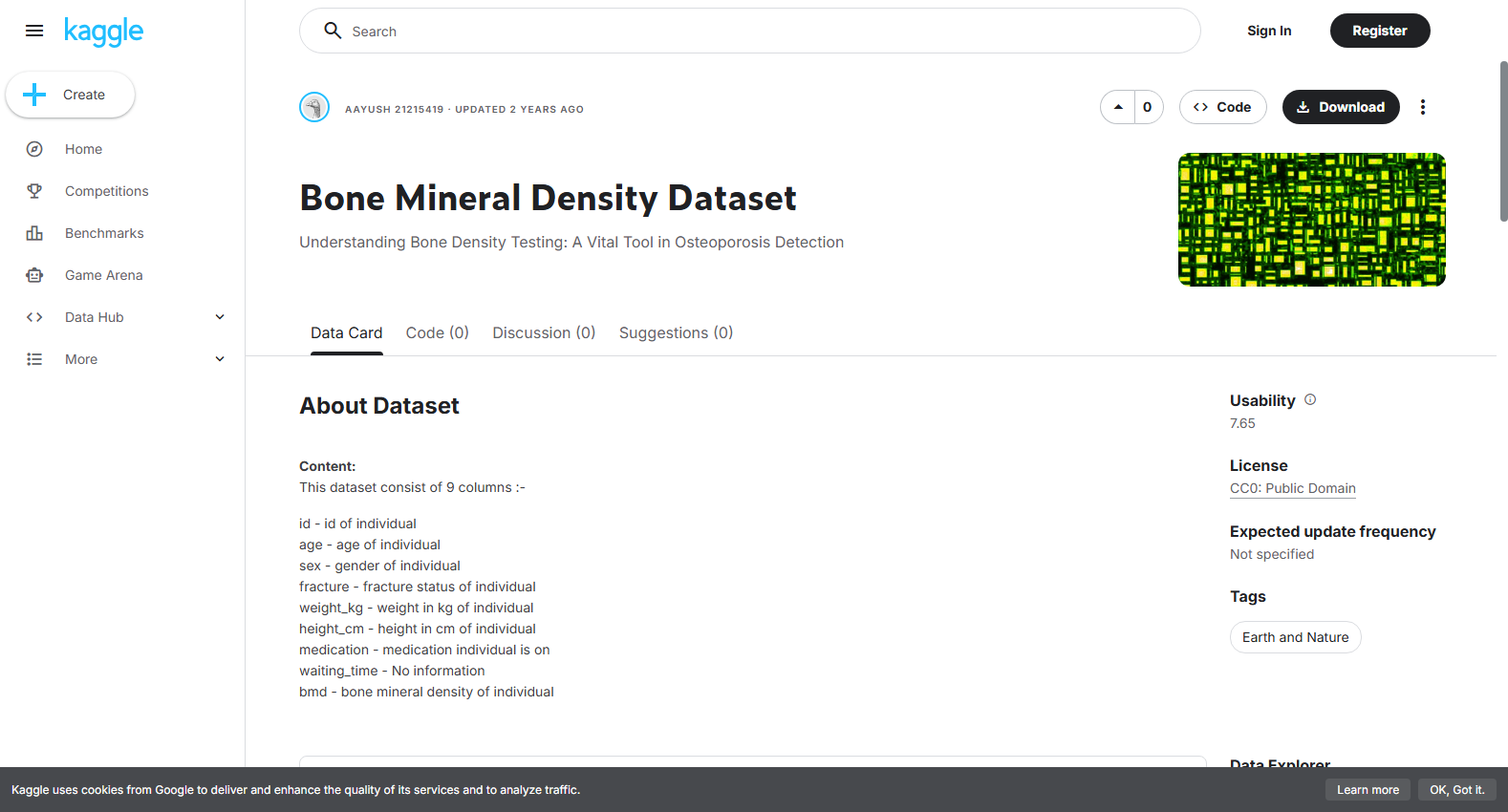 Bone Mineral Density Dataset