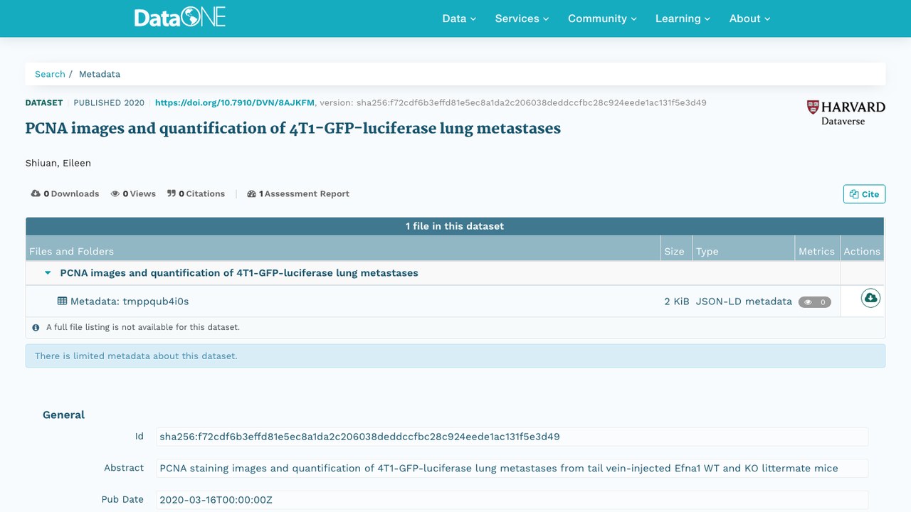 4T1-GFP-luciferase 肺转移灶 PCNA 图像及定量数据