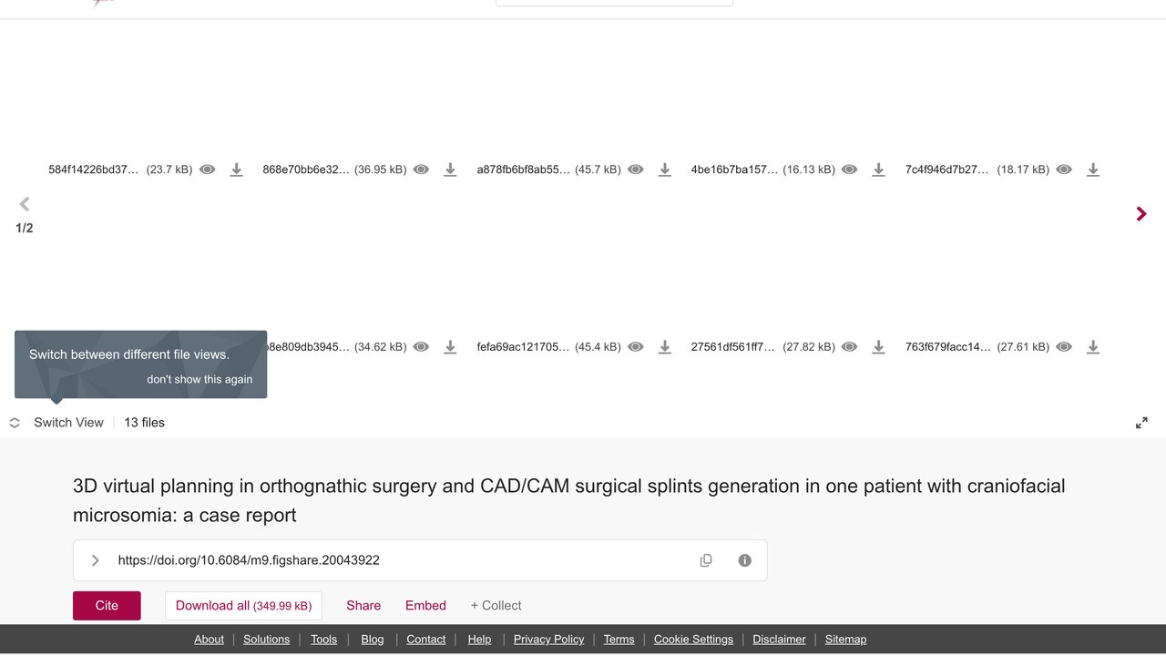 半面短小症正颌手术3D虚拟规划与CAD/CAM手术夹板生成病例报告数据