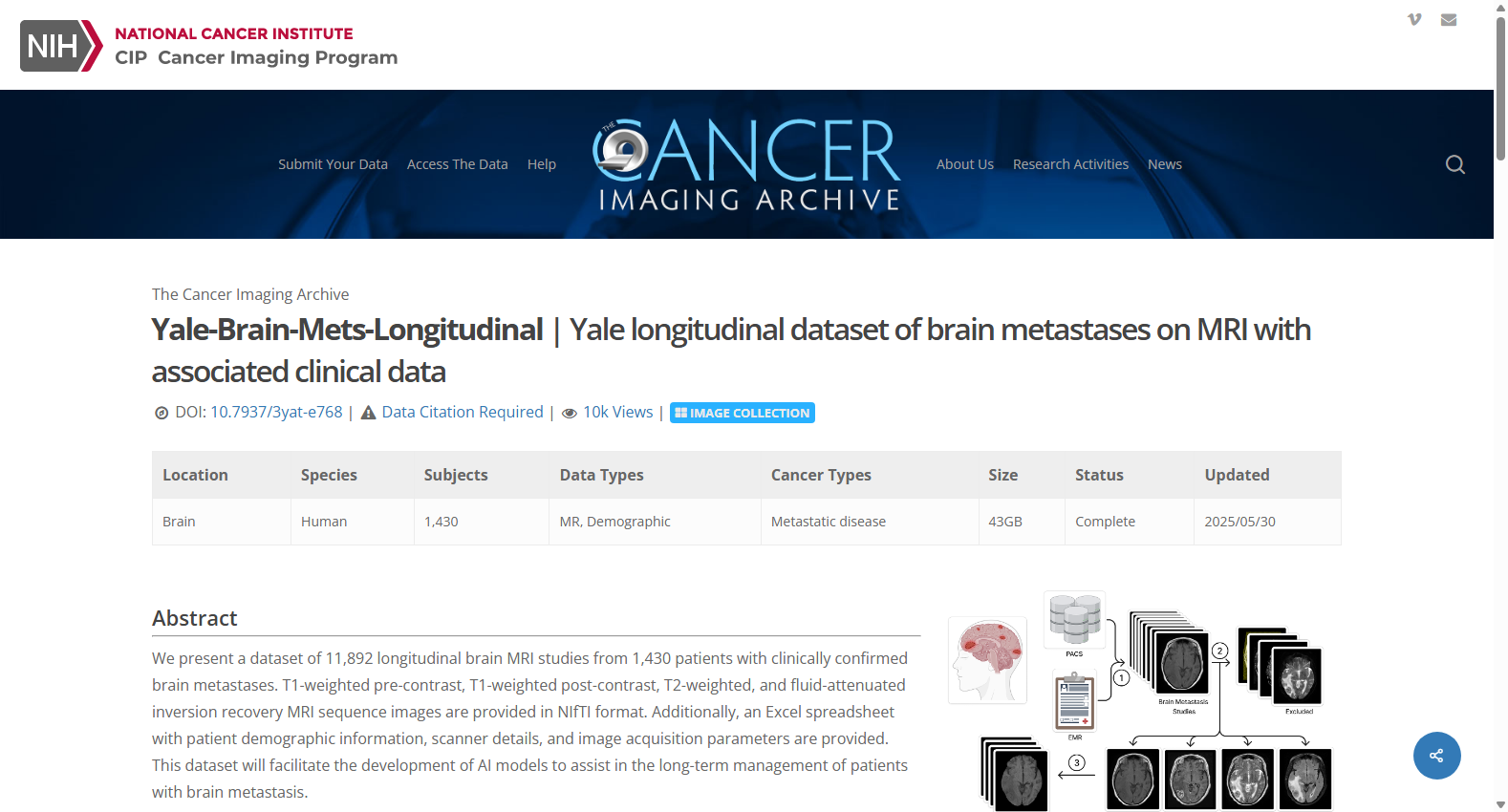 Yale-Brain-Mets-Longitudinal