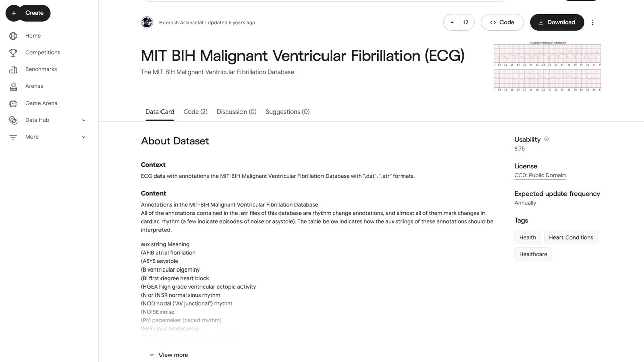 MIT BIH 恶性心室颤动心电图数据集