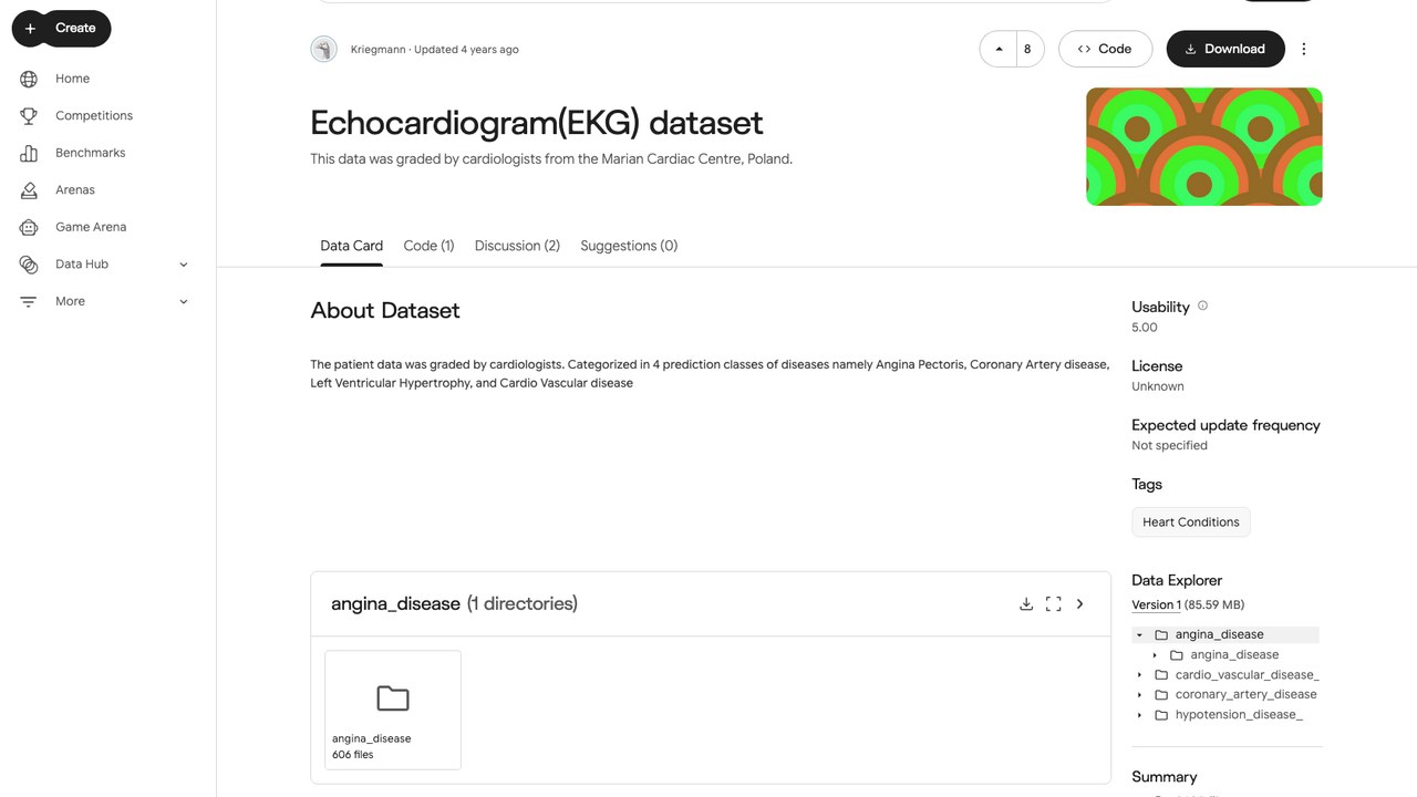 超声心动图(EKG)数据集