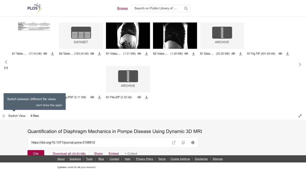 动态3D MRI量化Pompe病膈肌力学数据集