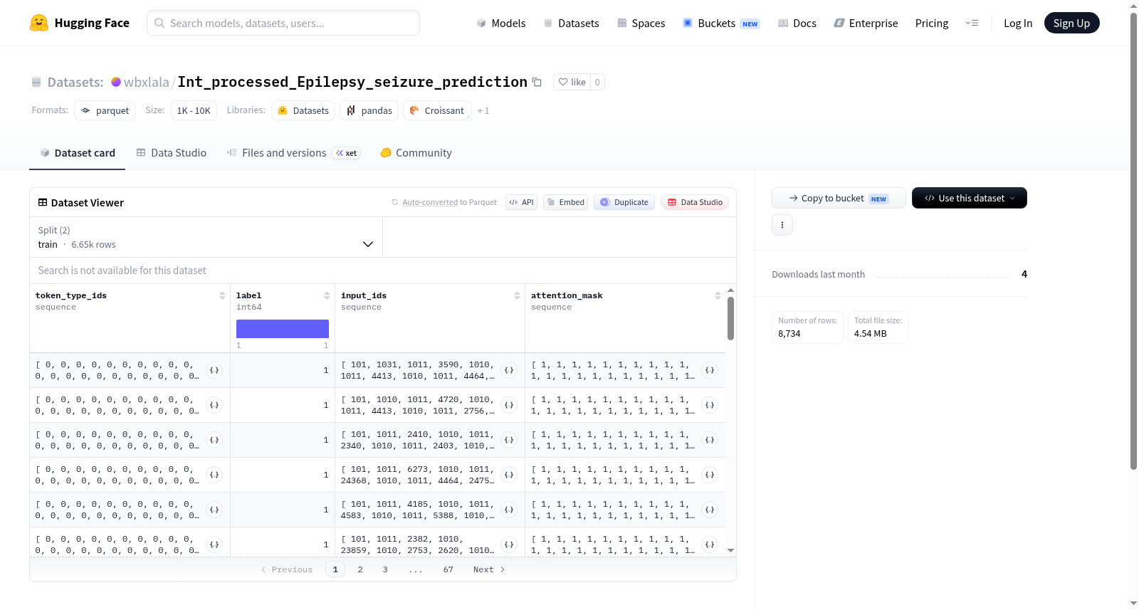 Int_processed_Epilepsy_seizure_prediction