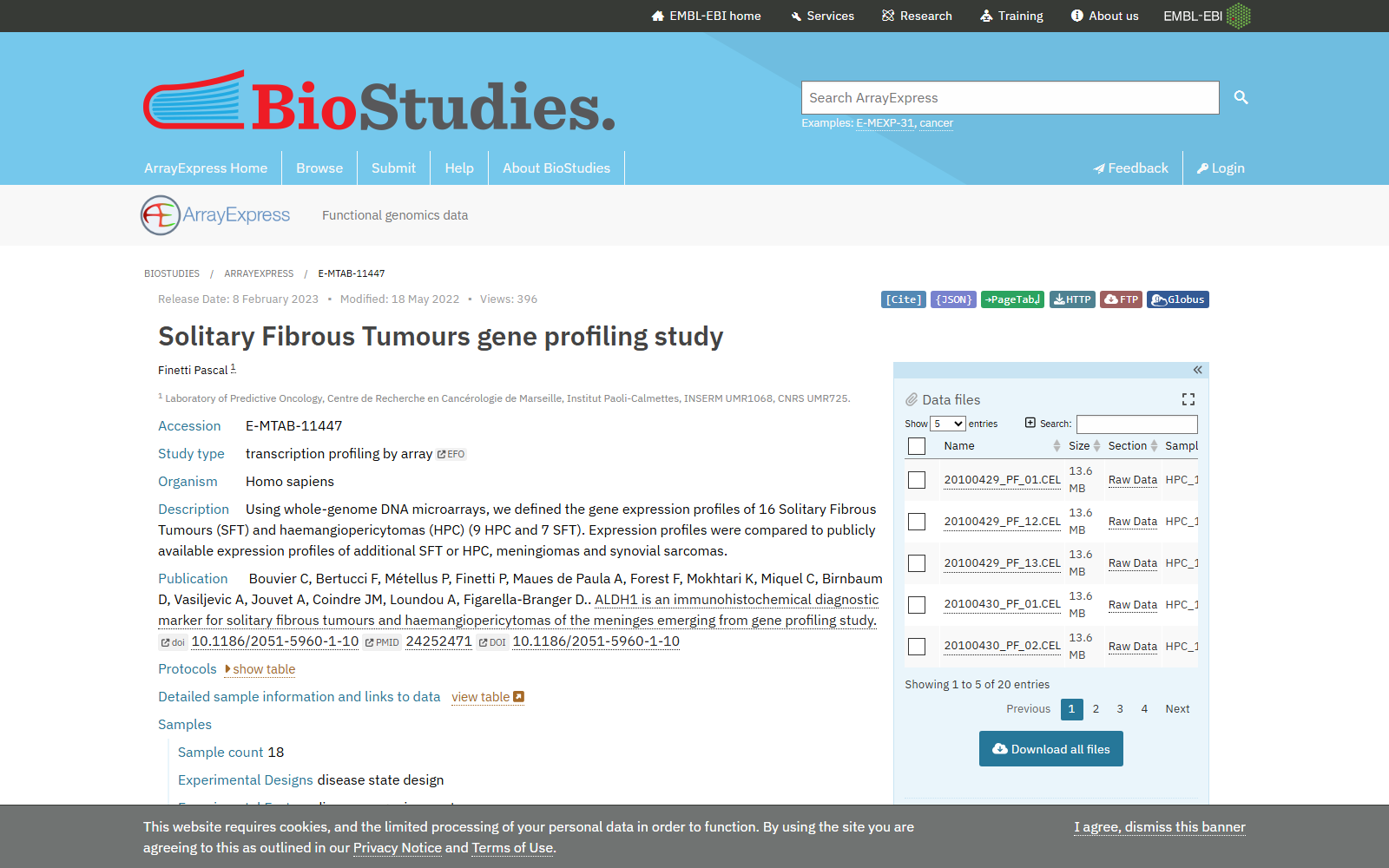 Solitary Fibrous Tumours Gene Profiling Study