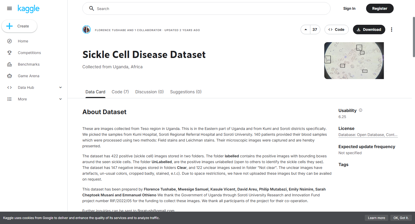 Sickle Cell Disease Dataset
