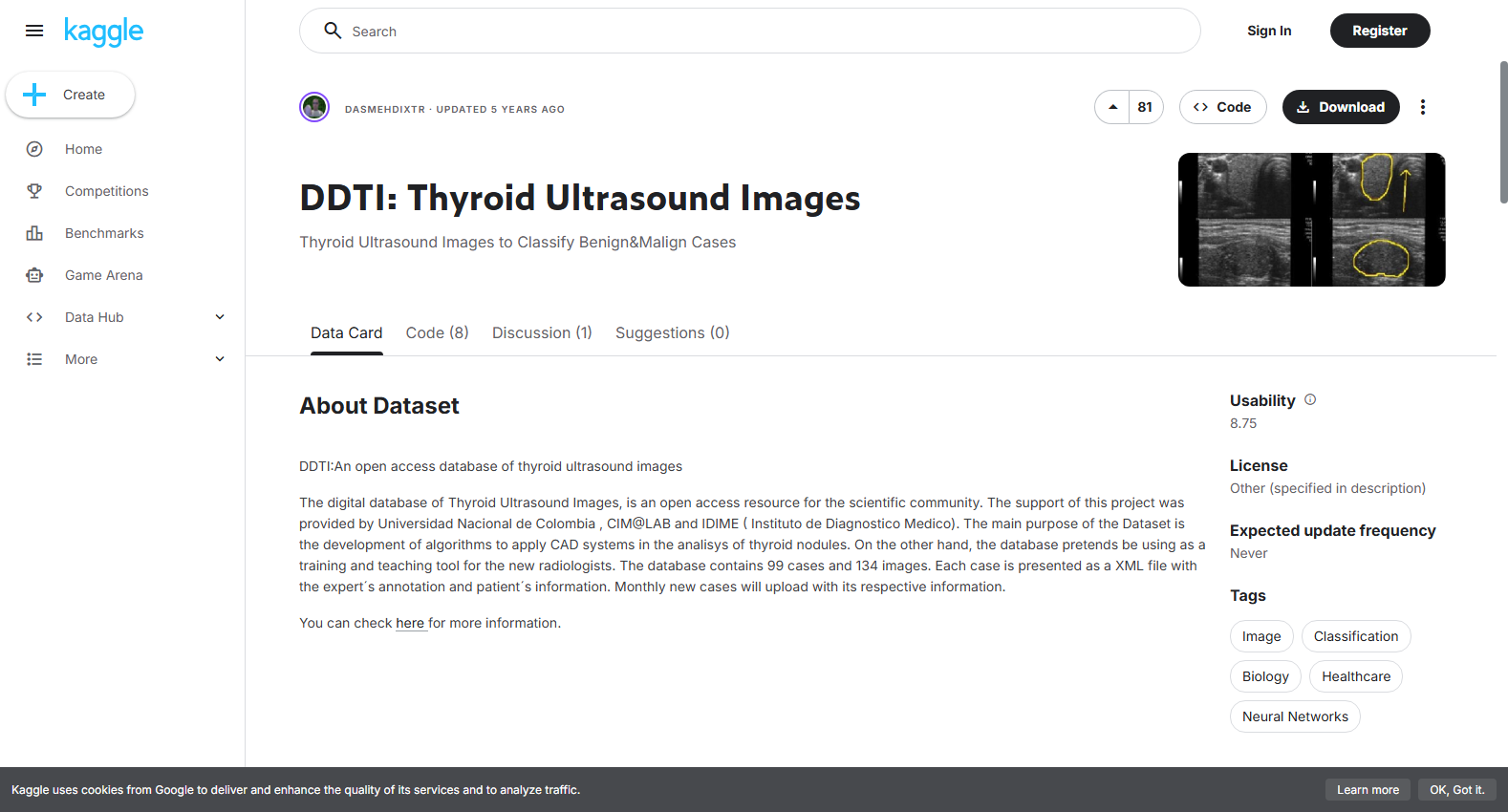 DDTI Thyroid Ultrasound Images