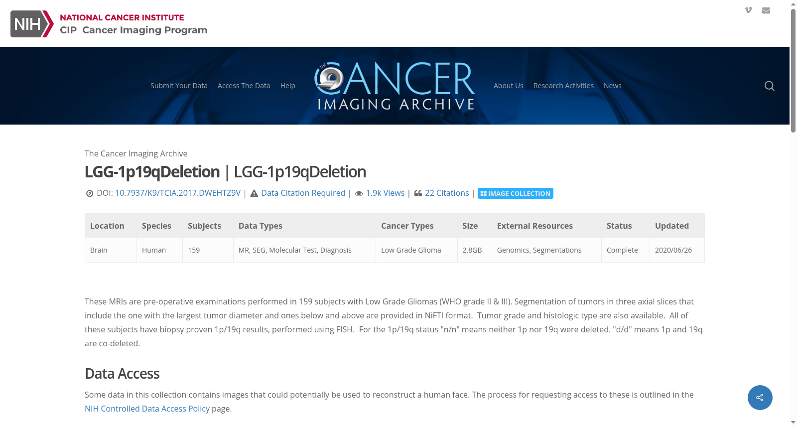 TCIA LGG-1p19qDeletion