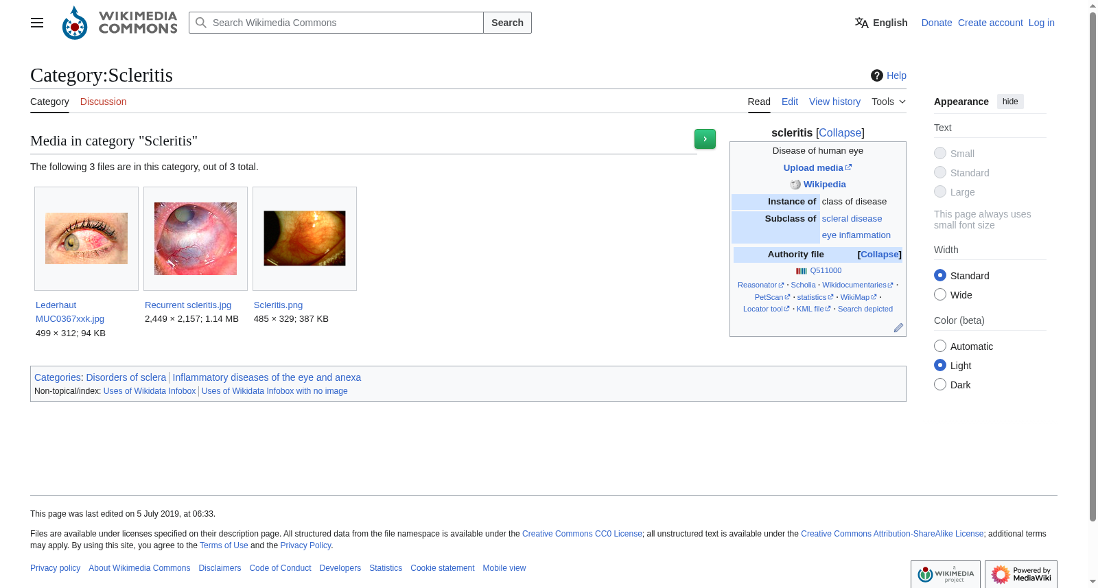 Wikimedia巩膜炎图像