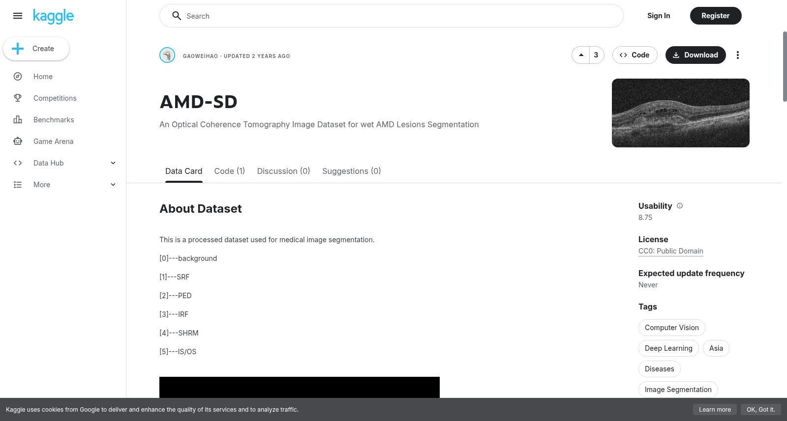 AMD-SD OCT分割数据