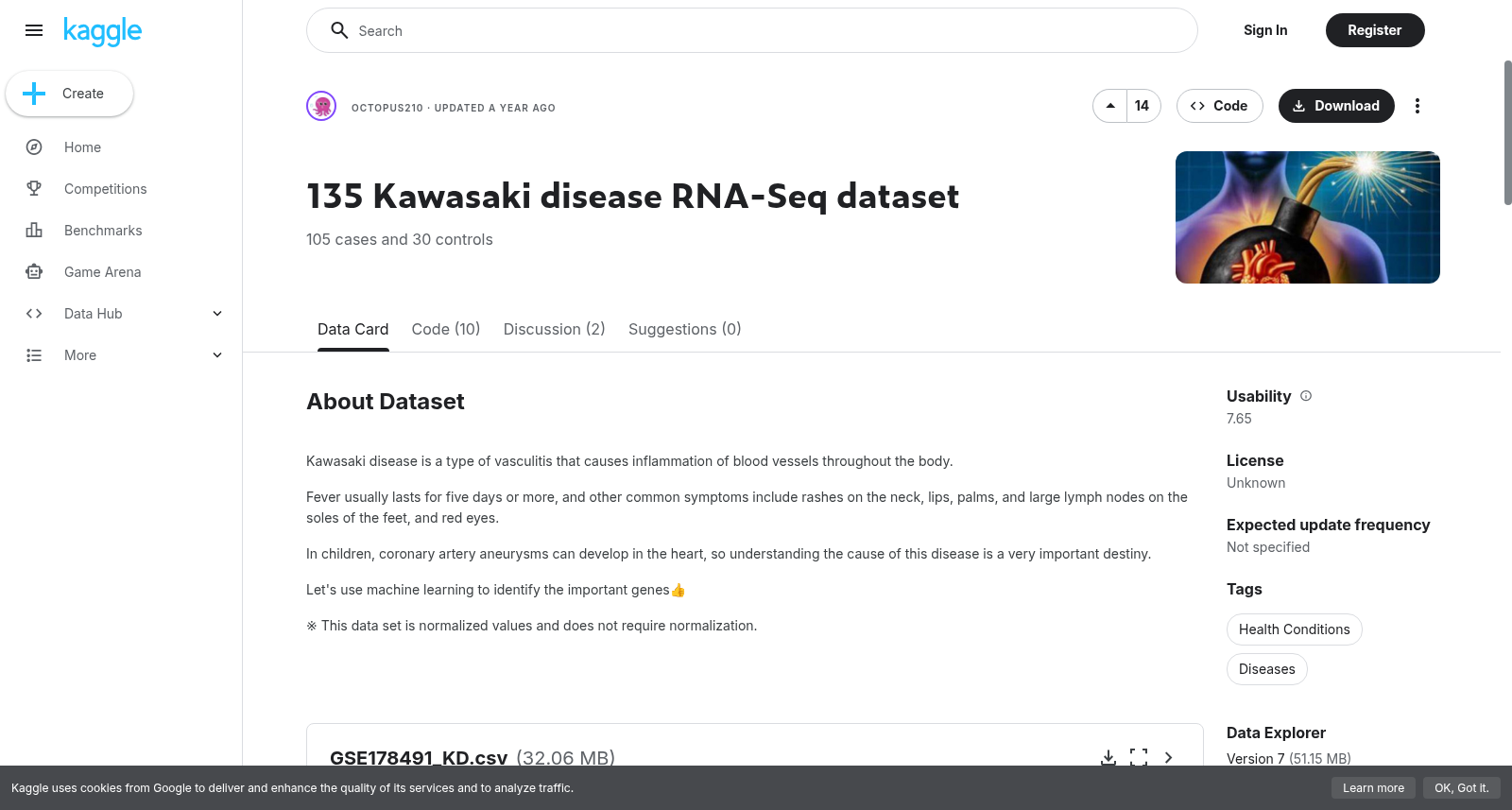 135例川崎病RNA-Seq数据集