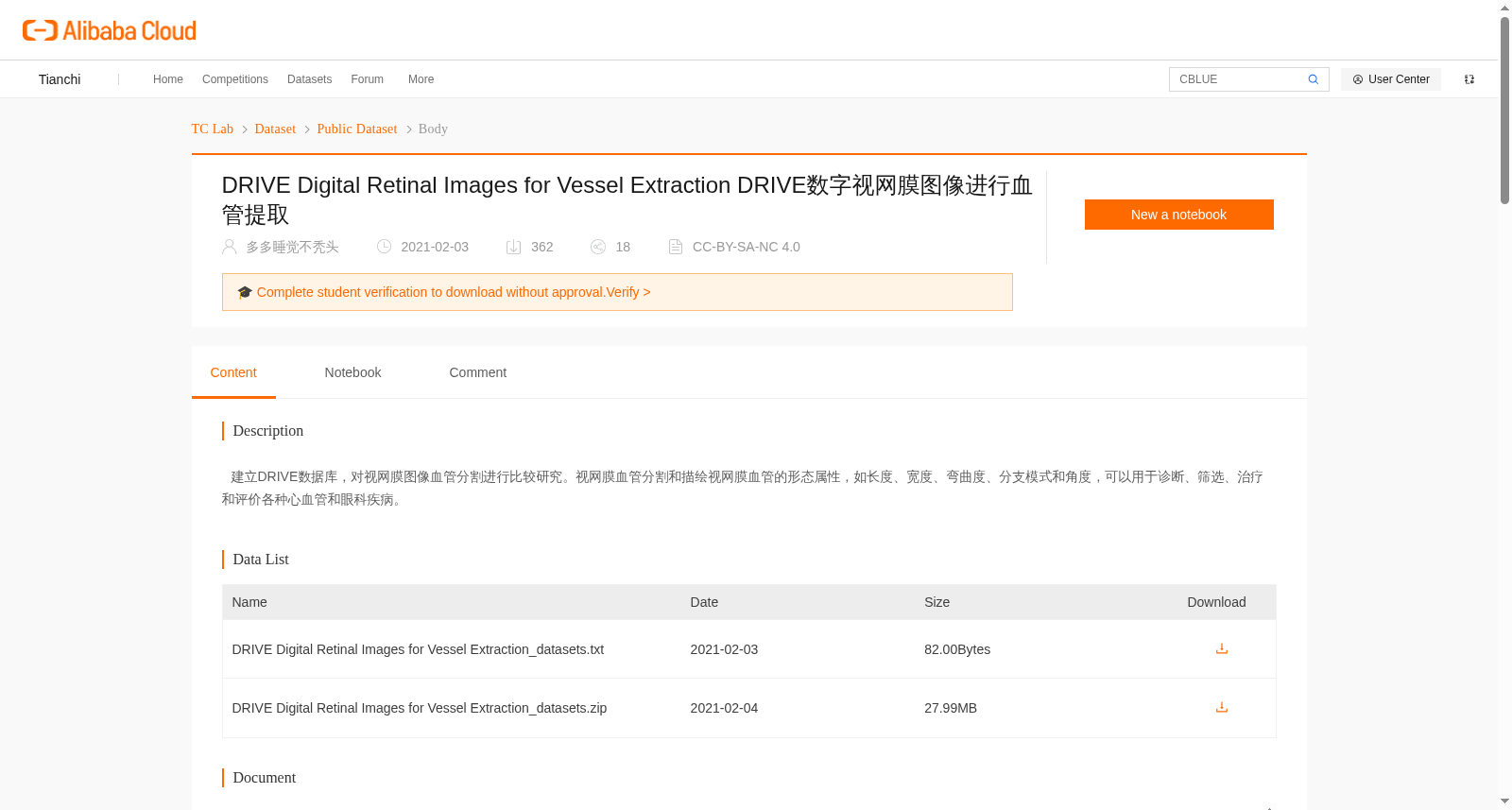 DRIVE数字视网膜图像进行血管提取
