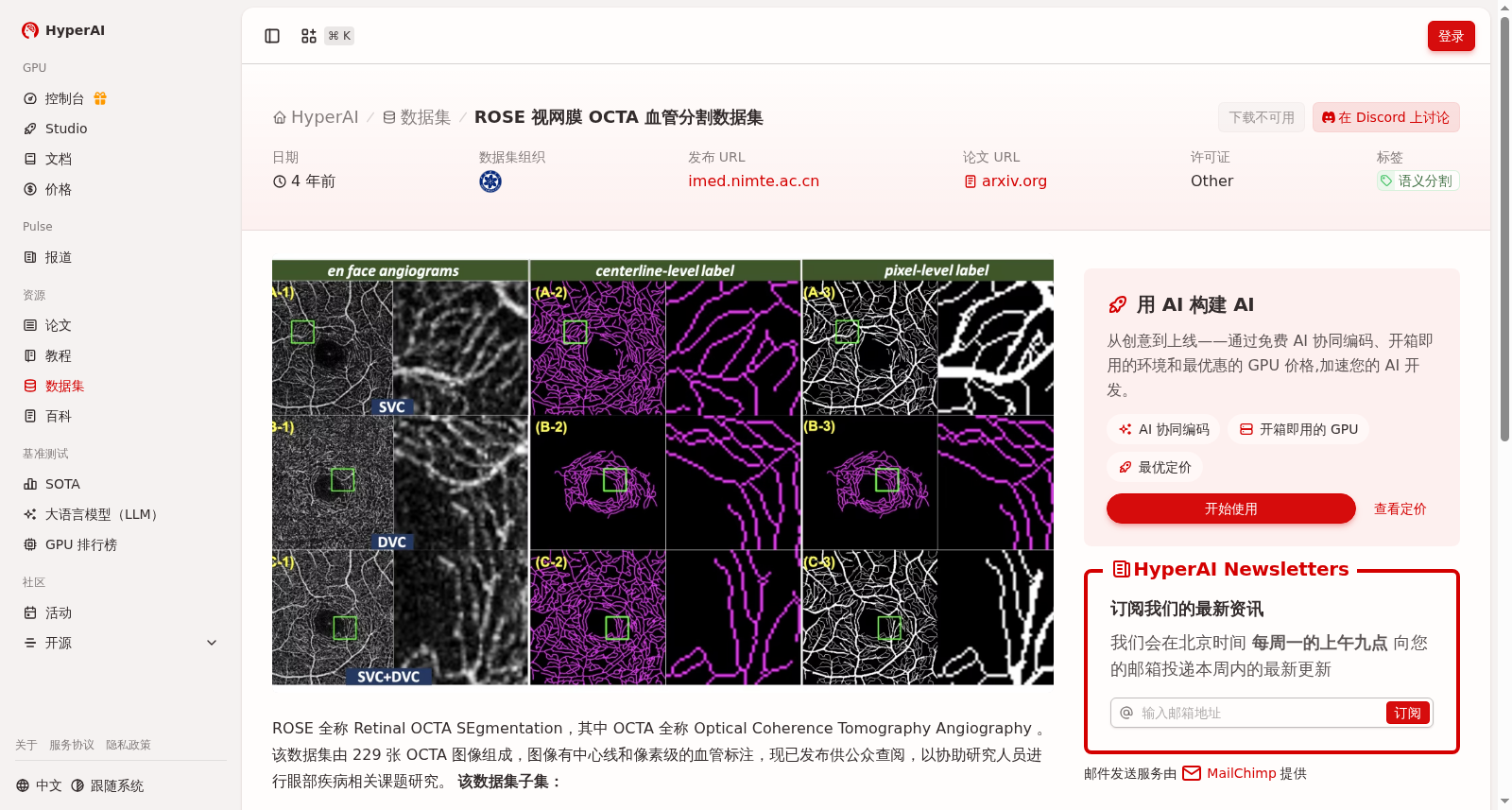 ROSE 视网膜 OCTA 血管分割数据集