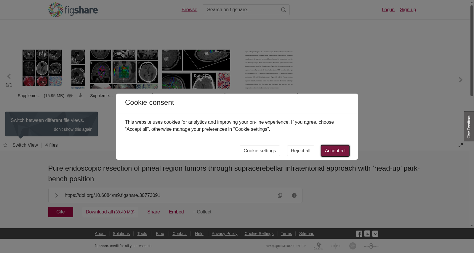 采用‘头高位’公园长椅体位经小脑幕下入路纯内窥镜切除松果体区肿瘤数据集