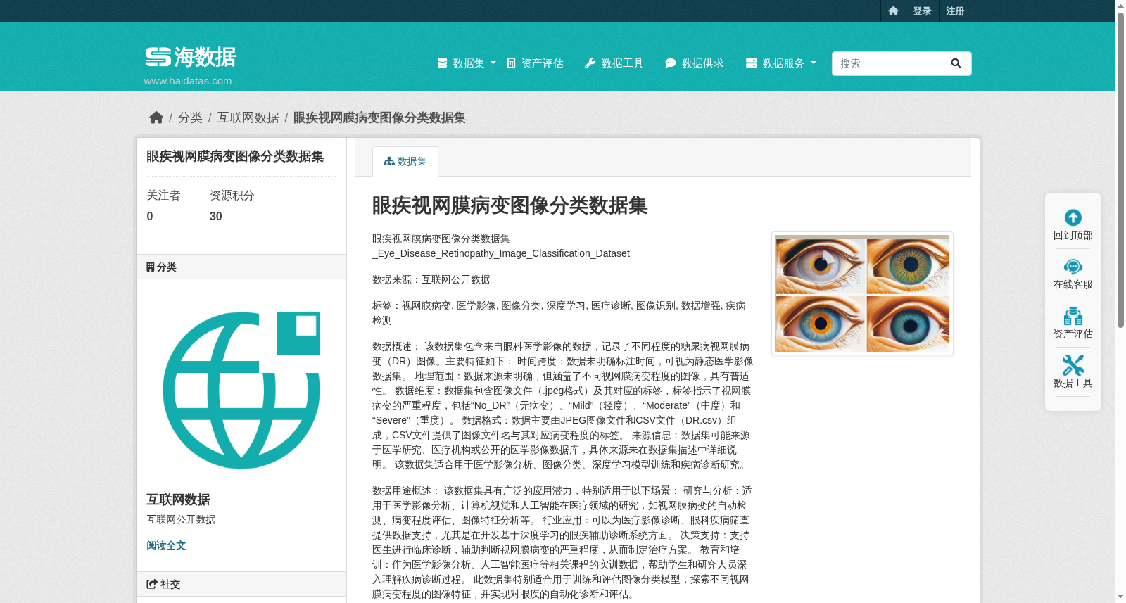 眼疾视网膜病变图像分类数据集