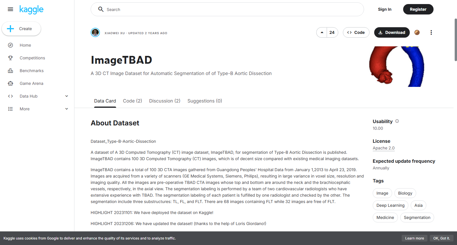 ImageTBAD