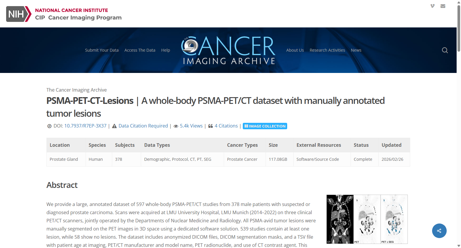 PSMA-PET-CT-Lesions