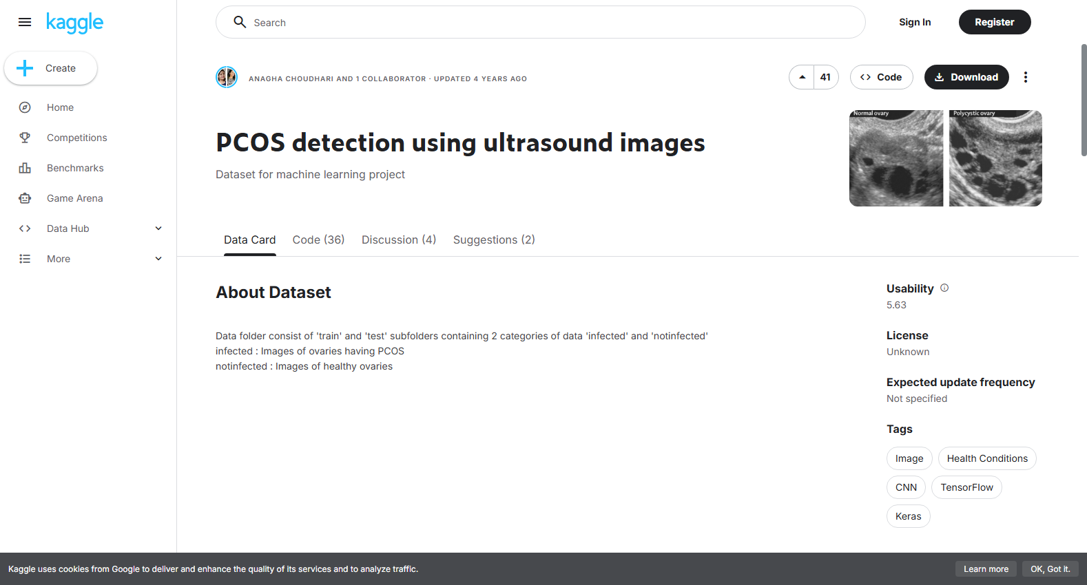 PCOS detection using ultrasound images