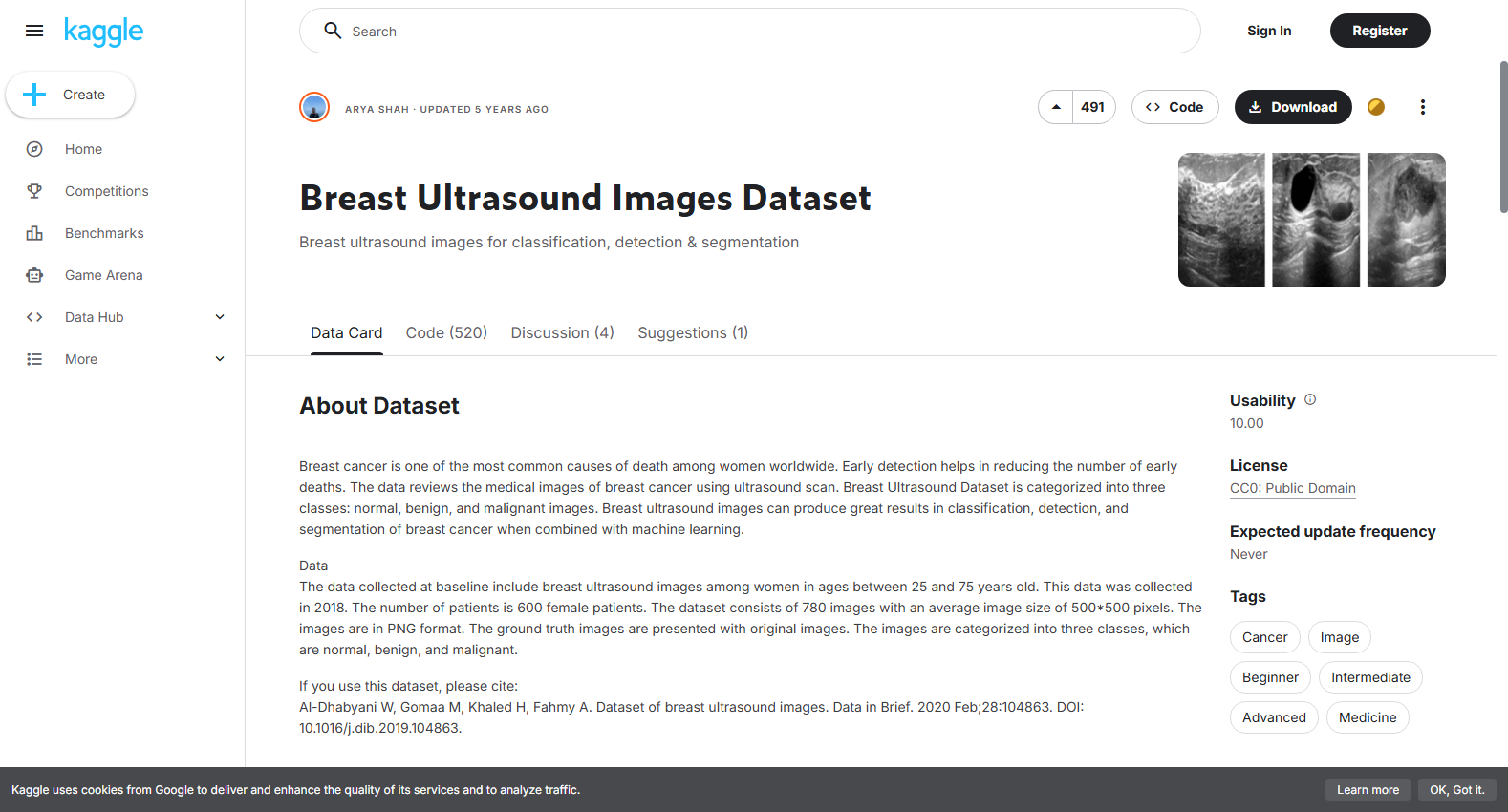 Breast Ultrasound Images Dataset