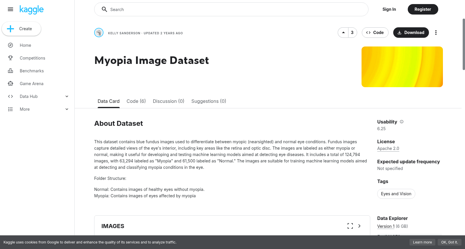 Myopia Image Dataset