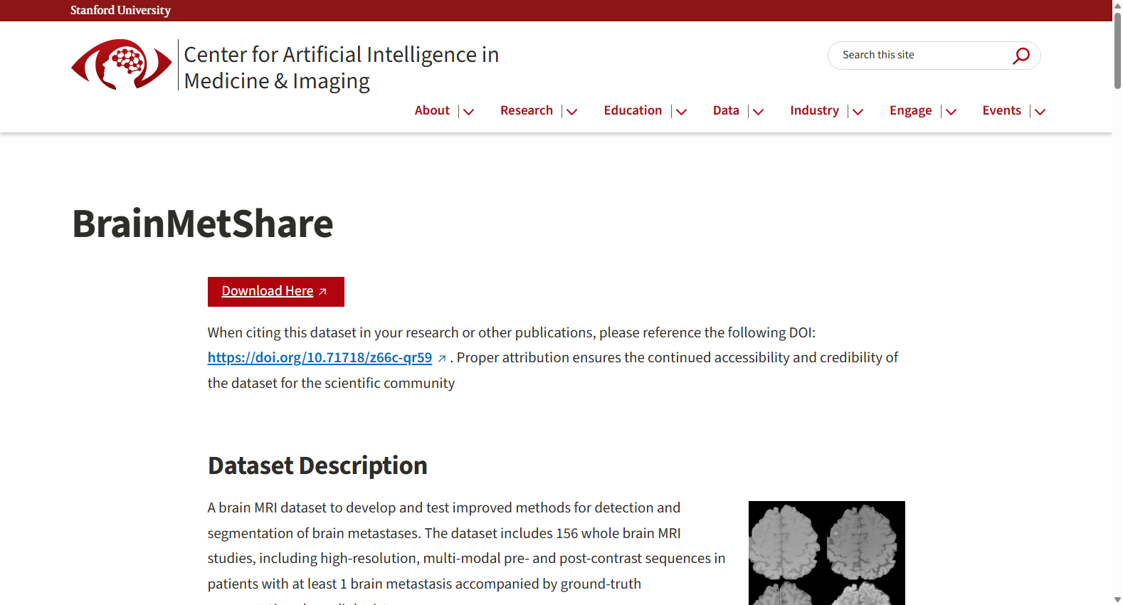 BrainMetShare