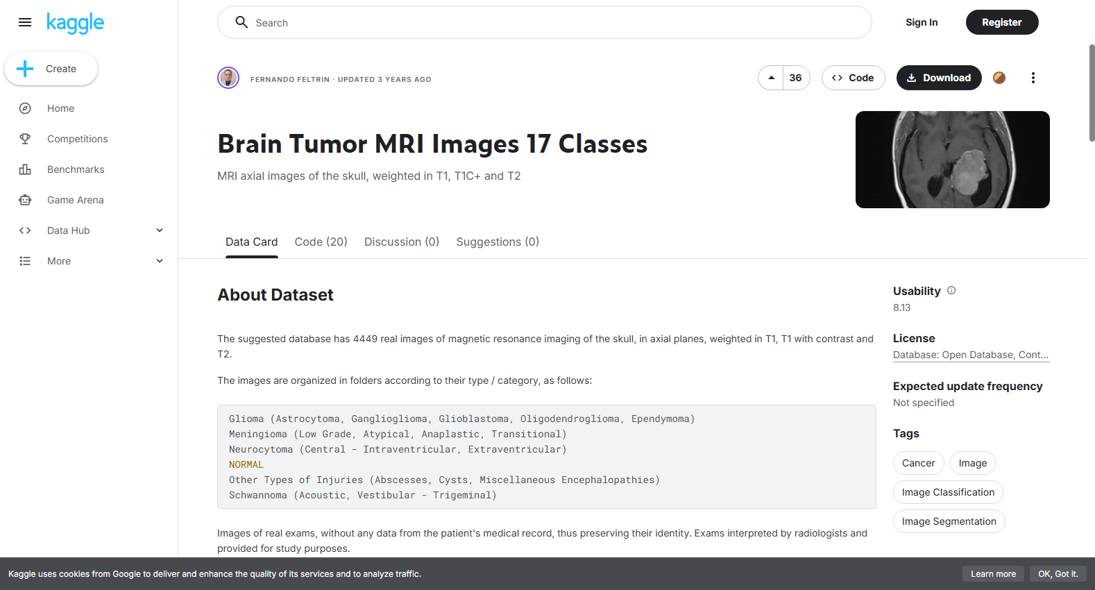Brain Tumor MRI Images 17 Classes