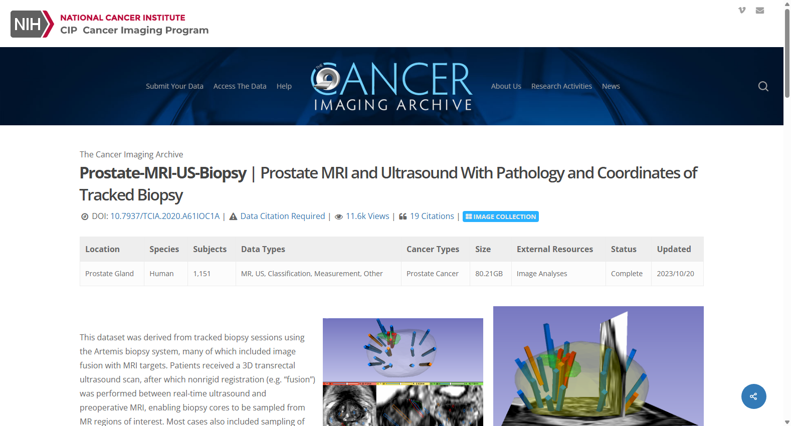 prostate-MRI-US-Biopsy