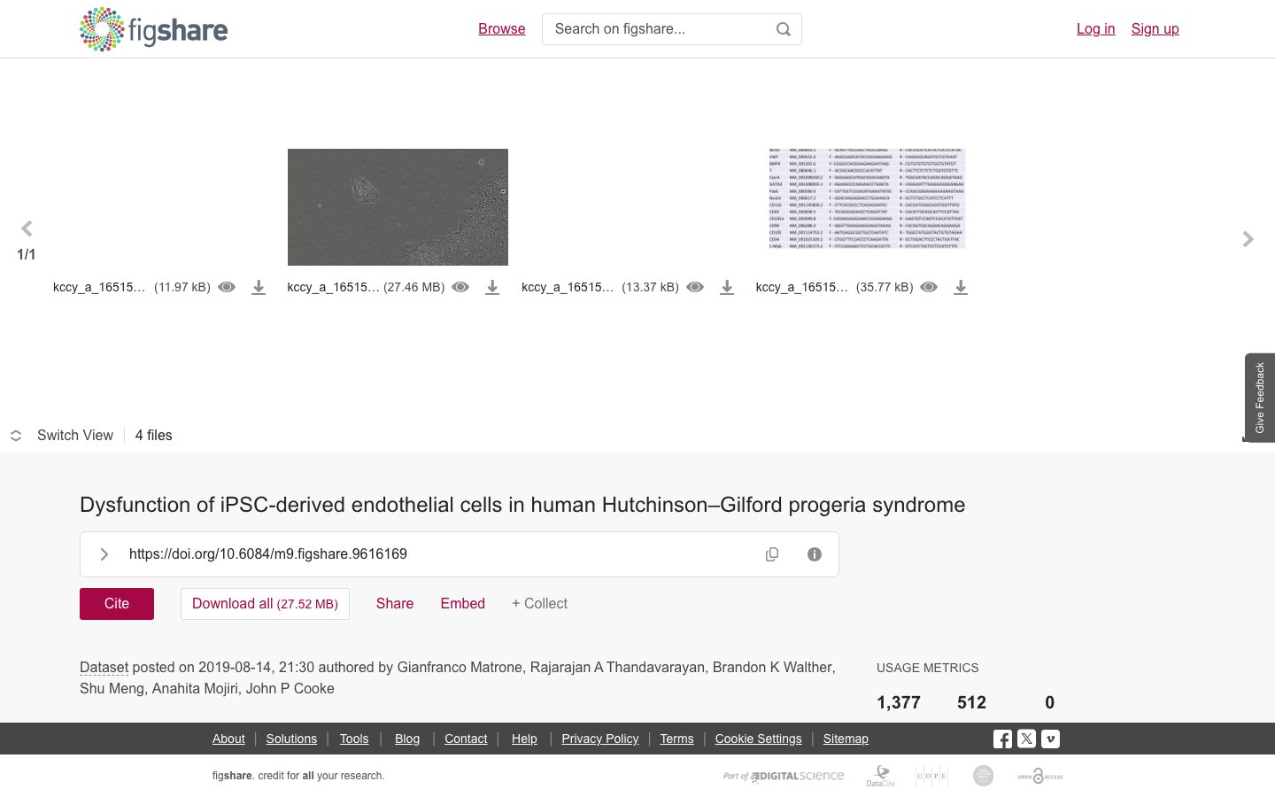 iPSC来源的内皮细胞在人类Hutchinson–Gilford早衰综合征中的功能障碍