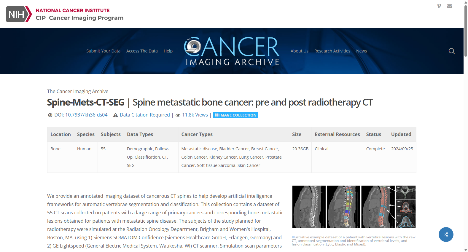 Spine-Mets-CT-SEG