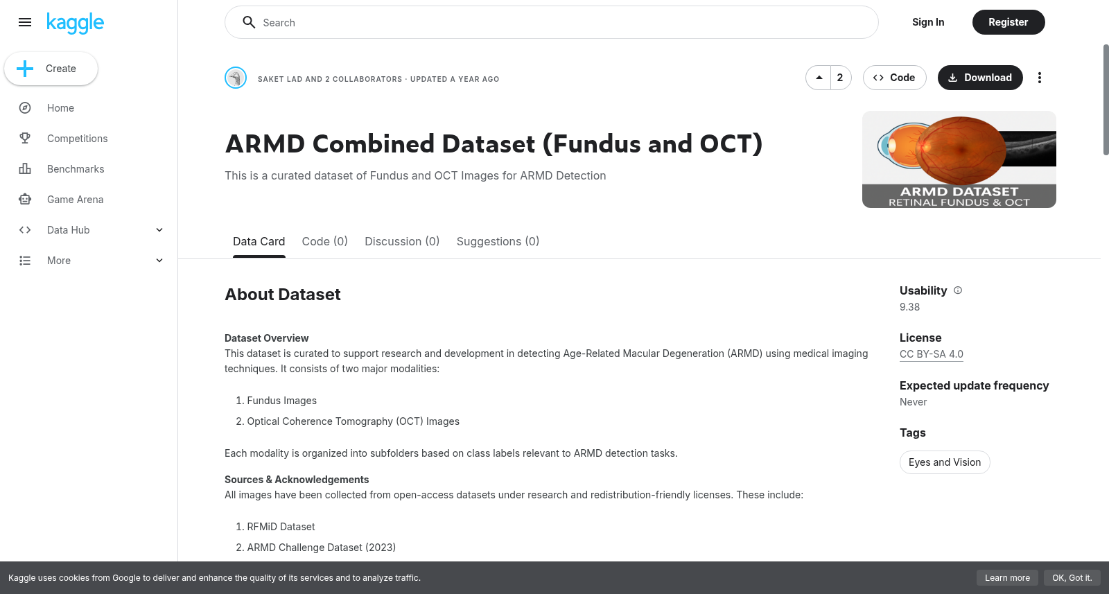 ARMD fundus和OCT联合数据