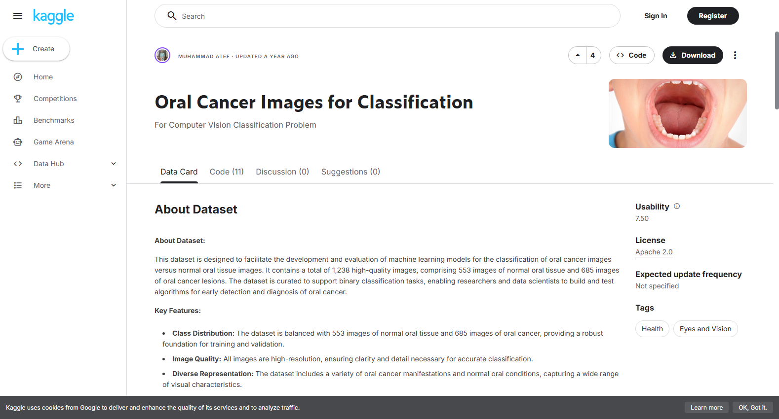Oral Cancer Images for Classification