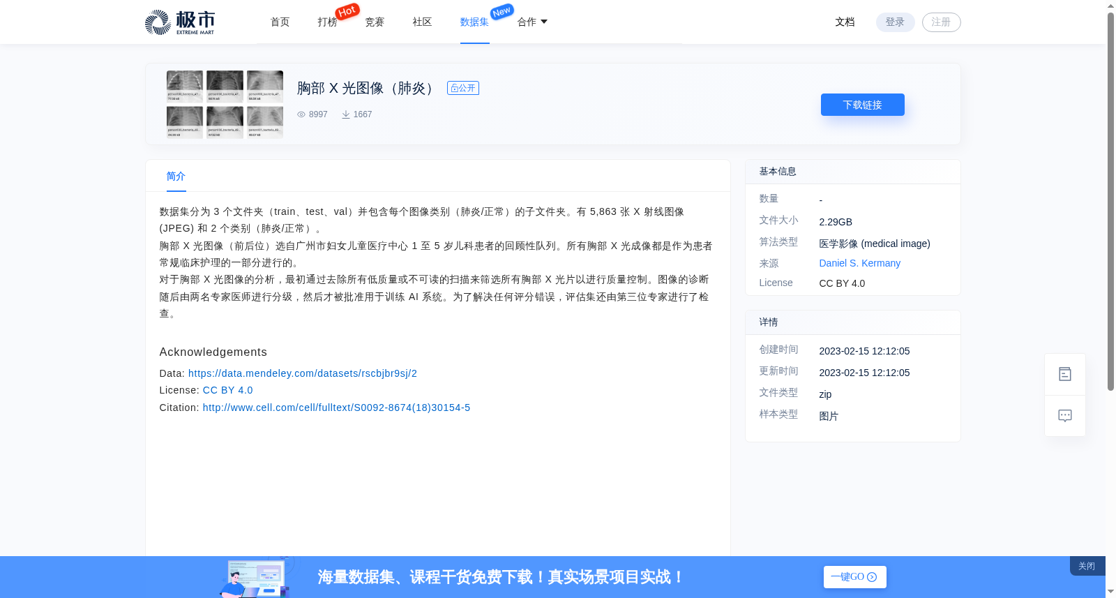 胸部 X 光图像(肺炎)