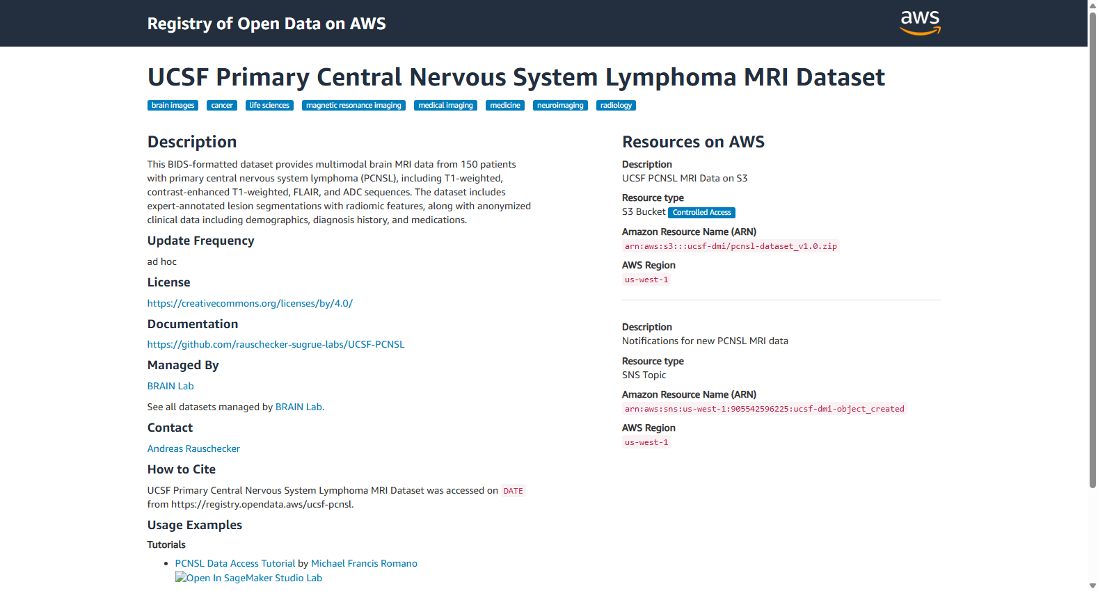 UCSF Primary Central Nervous System Lymphoma MRI Dataset